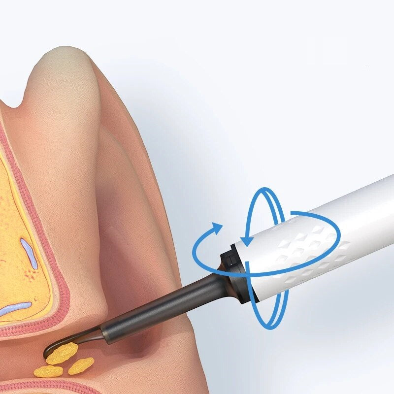 VistaClean™ – Weiß, wann Ihre Ohren wirklich sauber sind! [Letzter Tag Rabatt]