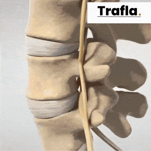 SpineEase™ – Genießen Sie volle Beweglichkeit ohne Rückenschmerzen! [Letzter Tag Rabatt]